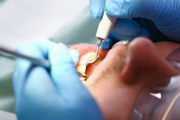 Best Emergency Treatment for Oral Infections in Coldspring, TX